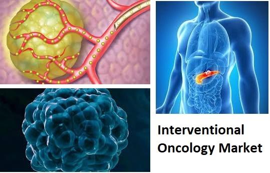 interventional oncology global market